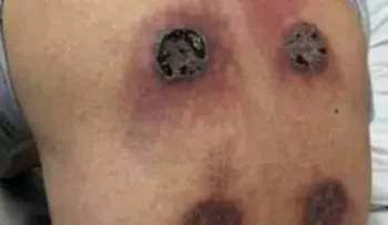 Este hombre se trataba el dolor en el hombro. ¡El resultado te dejará sin alientos!