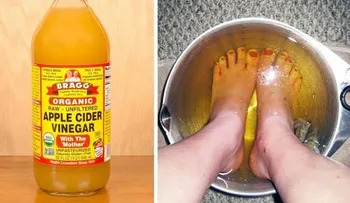 Asombrosos beneficios de sumergir los pies en agua caliente con vinagre de manzana durante 15 minutos