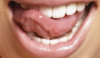 Mi abuela se aplicaba esto tres veces a la semana y hasta los 75 años no fue al dentistaâ?¦ 