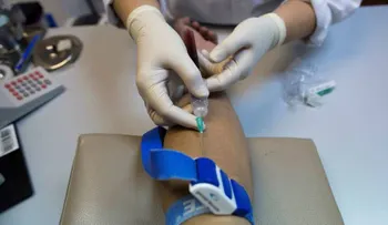  La prueba del Sida se podrá comprar en farmacias españolas sin receta médica 