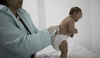 El Papa dice anticoncepción es perdonable en caso de zika