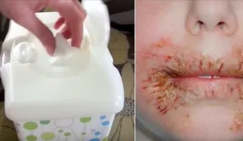 Los doctores aconsejan no utilizar toallitas de bebe por el bien de nuestros hijos