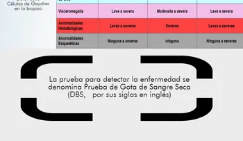 Esperabas leucemia Es enfermedad de Gaucher