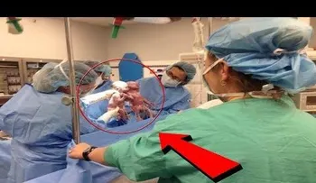 Los médicos no paraban de gritar cuando nacieron estas GEMELAS