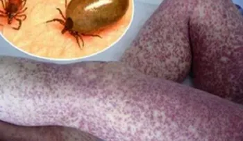 Estos son los peligros a los que te expones durmiendo con tu mascota