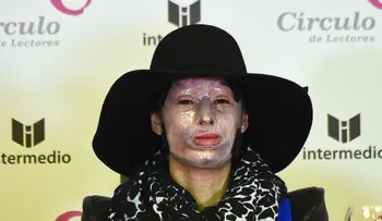 Colombia endurece penas contra quienes ataquen con ácido a las mujeres