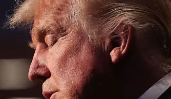 Trump está tomando medicina para la caída del pelo, dice su doctor