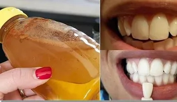 Haz gárgaras con este simple ingrediente y veras qué pasa a los dientes