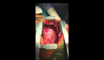 No apto para sensibles: Le sacan una espada clavada en el corazón (VIDEO)