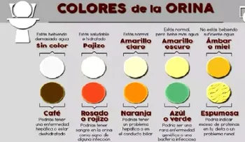 Descubre la enfermedad que puede tener con el color de tu orina