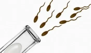 Asocian la infertilidad masculina a un mayor riesgo de cáncer de testículo