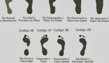 Ponerte zapatilla o calzado inadecuados mata tu pies