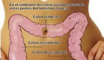 Para curar el colon irritable