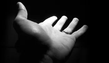 Un español se amputa una mano para cobrar 2 millones de euros de once aseguradoras