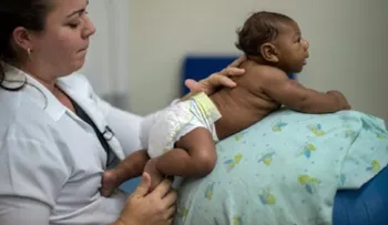 Zika: Bebés normales pueden desarrollar microcefalia el primer año