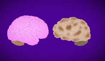 Investigación muestra un esperanzador fármaco contra el Alzheimer