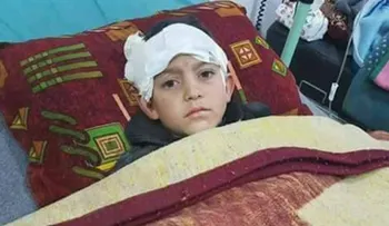 Un niño pierde sus piernas y ruega por la ayuda de su padre en la guerra siria