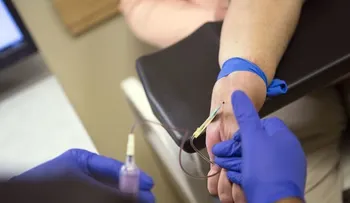  Acceso a diagnóstico y tratamientos, reto de Latinoamérica ante hepatitis C 