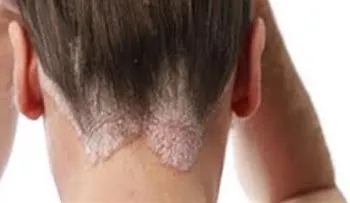 7 padecimientos que son causados por dormir con el pelo mojado