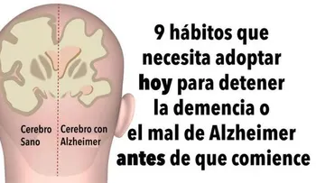 9 hábitos que necesita empezar para detener la demencia o el mal de Alzheimer 