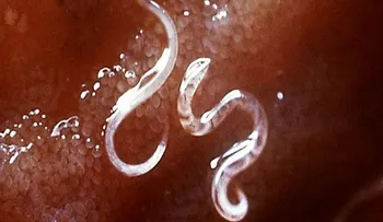 Los científicos quieren usar gusanos parásitos para tratar con éxito la esclerosis múltiple...