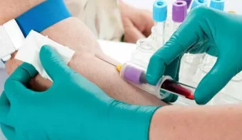 Hiperparatiroidismo primario normalmente no ocasiona síntomas en las primeras etapas