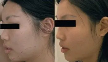 Beneficios de tener un rostro más estatizado
