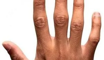 Dicho por un estudio: El dedo índice y anular diferente puede indicar mayor tendencia a ser lesbianas