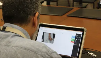 Doctor usa iPad para realizar cirugía a distancia en Gaza