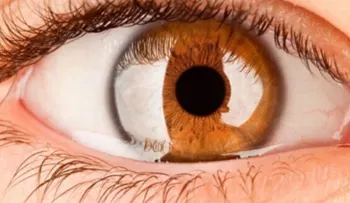 ¡Pendiente! La salud ocular también requiere cuidados