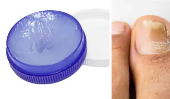 Lo que nadie te había dicho de este ungüento increíble. Antes y después. ¿Quieres Saber más?, sigue leyendo?