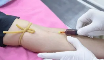 Médicos salvaron a un hombre que tenía la sangre sorprendentemente espesa