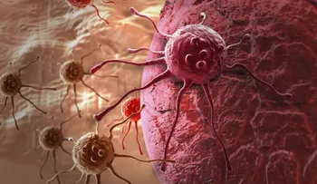 ¿Por qué hay cada vez más casos de cáncer? 3 posibles razones