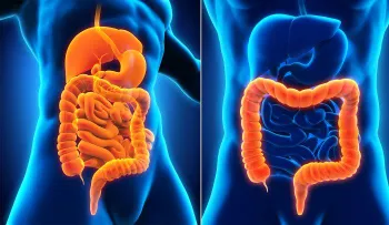 Colitis ulcerosa: ¿Cuáles son sus síntomas y causas?