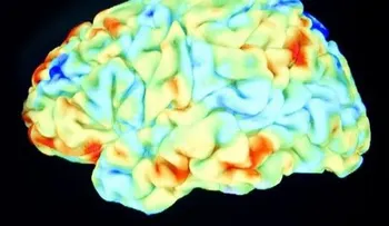 El amor modifica el cerebro, según estudio