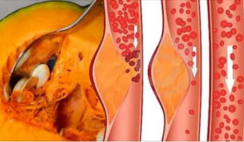 A mis 49 años nunca he sufrido de colesterol y arterias obstruidas, quiero compartir mi secreto contigo