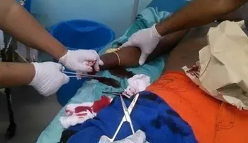 Hombre le corta la mano a su hermano durante riña en Restauración