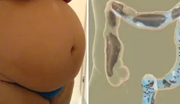 Maravilloso remedio para quitar en pocos minutos los gases y la hinchazón de la barriga 