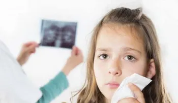 Tips para reducir el dolor después de extaer un diente