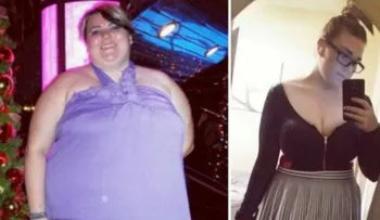Era horrible por su excesivo peso, pero dio un cambio radical a su vida