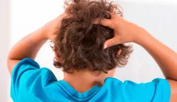 Pediculosis: Cómo combatir la molesta picazón
