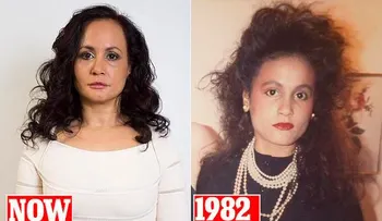 No sonríe desde hace 40 años por temor a las arrugas