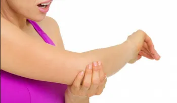 La inflamación por la psoriasis puede afectar las articulaciones 