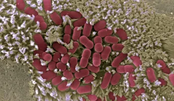 La Inteligencia Artificial ayuda a descifrar cómo las bacterias infectan las células humanas