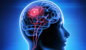 Dra García revela que los tumores cerebrales tienen una sobrevida a 5 años de 33.2 %