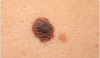 Hallan una nueva vía para las terapias contra el cáncer 