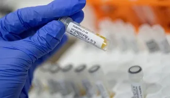El Gobierno colombiano compra nueve millones de vacunas de Johnson & Johnson