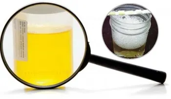 Si tu orina hace espuma, podría causarte una insuficiencia renal