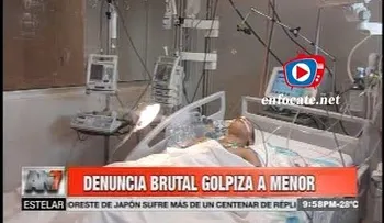 Denuncia que policías golpearon brutalmente a su hijo de 14 años (VIDEO)