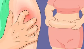 10 signos de niveles muy altos de azúcar en la sangre y cómo reconocerlos